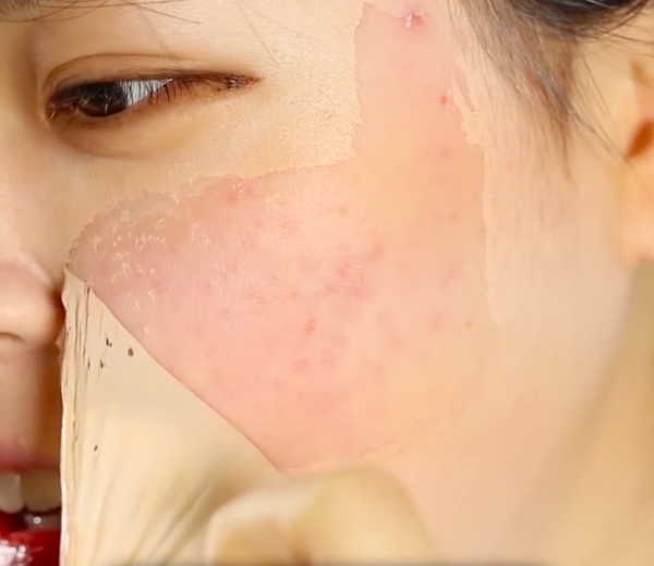 Gel va da che mun, seo than thanh Not4U Real Skin Patch - Han quoc (3)(1)